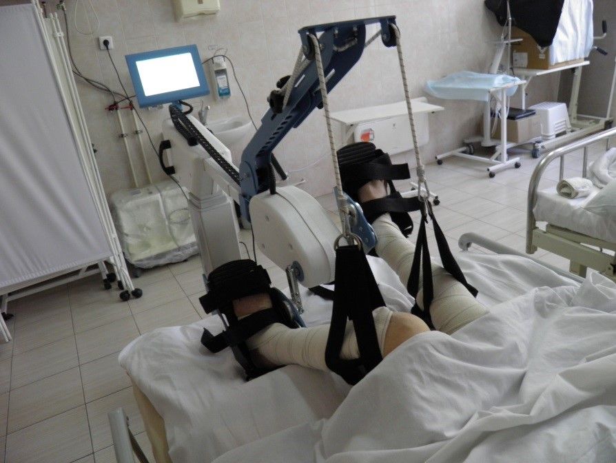 Аппарат для механотерапии «Орторент»​​. (Фото Минздрава РМЭ).