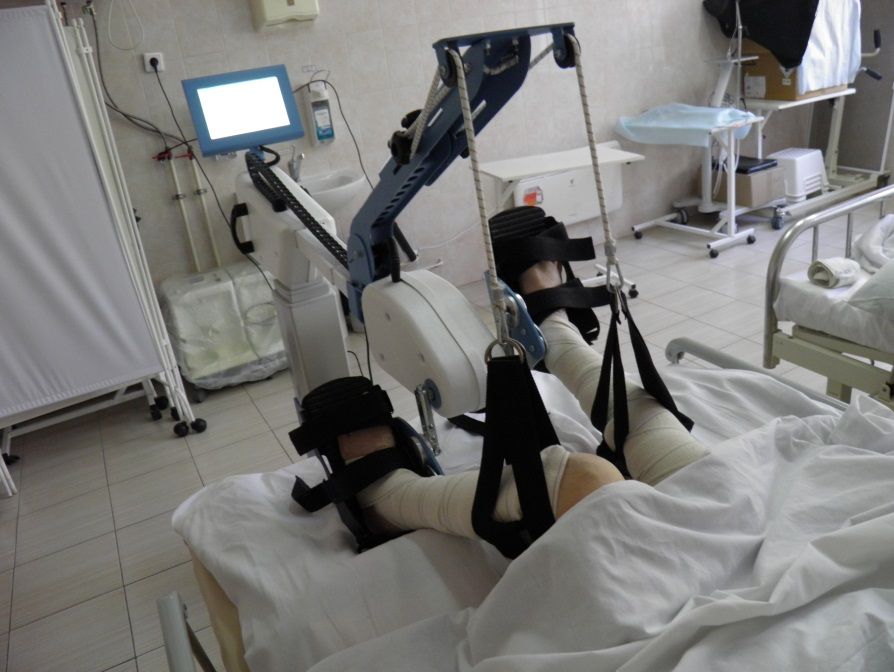 Аппарат для механотерапии. (Фото Минздрава РМЭ).