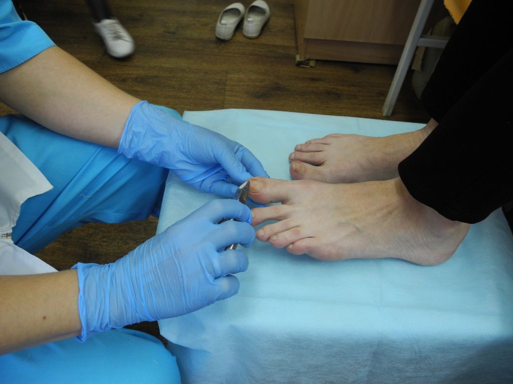 Вылечить грибок самостоятельно практически невозможно. (Фото Натальи Кулишовой).